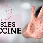 Measles Immunization: The Best Age for Kids to Get Vaccinated