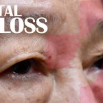 Orbital Fat Loss 101: Everything You Need to Know