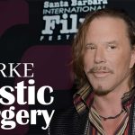 Mickey Rourke Plastic Surgery