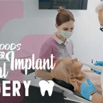 50 Soft Foods to Eat After Dental Implant Surgery (Expert Advice)