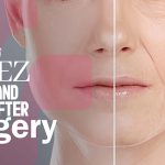 Sanya Lopez Before And After Surgery: Fascinating Transformation Exposed