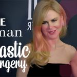 Nicole Kidman Plastic Surgery Secrets Exposed!