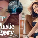 Jade Rasif Plastic Surgery: Insider Look You Need