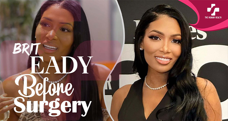 Brit Eady Before Surgery