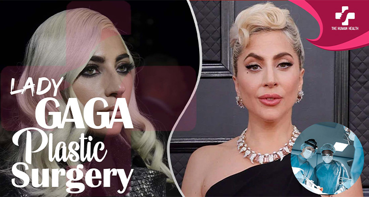 Lady Gaga Plastic Surgery